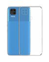 Soft Back Cover for Poco C31 / Redmi 9 Activ